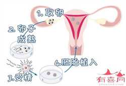 北京供卵自怀，做泰国试管婴儿子宫内膜厚度需要多少？
