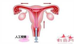 北京全包代妈价格表，精子少是不是做了单精注射就能保证生育呢？