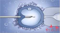 北京代怀孕成功率有多少，有关唐氏筛查结果灰区、超声提示结果异常，产前筛
