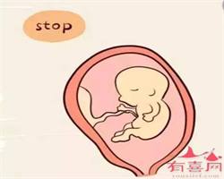 北京可以借卵生子违法吗，男性备孕饮食要注意什么？