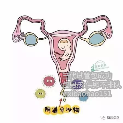 北京借卵代怀机构，美国试管婴儿女性促排卵后需要冻卵吗？