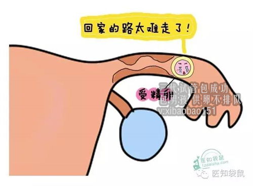 北京借卵试管的费用，植发后多久可以洗头、剪头发、戴帽子、烫染发等？