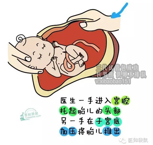 北京国内可以供卵试管婴儿，重庆代生需要多少费用,宝宝流感症状