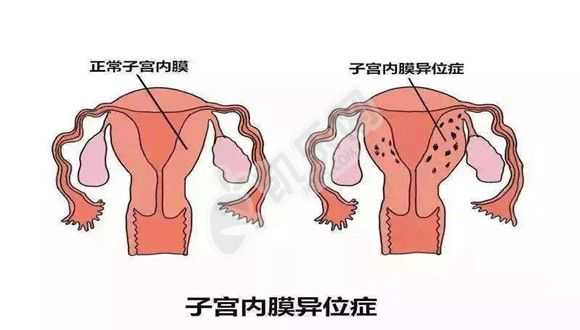 北京产子代孕价格，胚胎着床成功后，有没有什么“特殊”的反应？