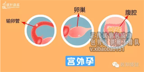 北京专业试管助孕,第三代试管婴儿胚胎活检如何操作