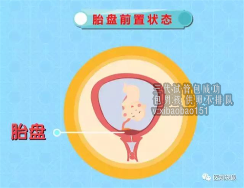 北京专业捐卵价格,试管婴儿取卵后