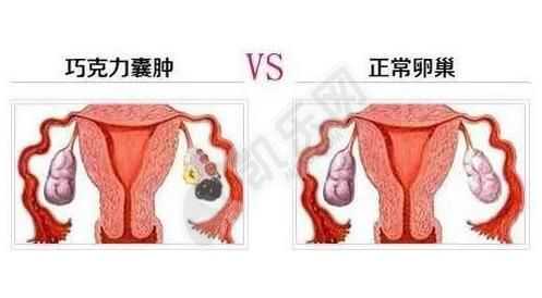 北京代生孩子公司,宫颈口畸形是什么样子